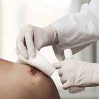fita micropore preço