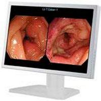 Monitor endoscopia