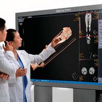 Monitor médico alta resolução