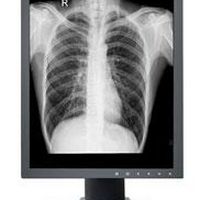 Monitor radiologia