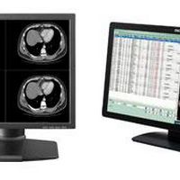 Monitor radiologia digital