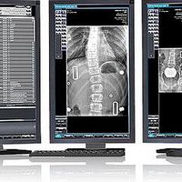 Software de Imagem PACS DICOM