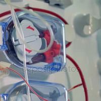 sonda para gastrostomia percutânea com balão