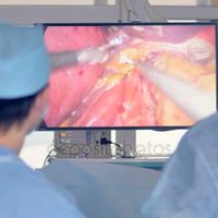 sonda para gastrostomia percutânea com balão